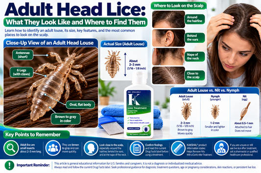 Adult Head Lice: Appearance and Signs